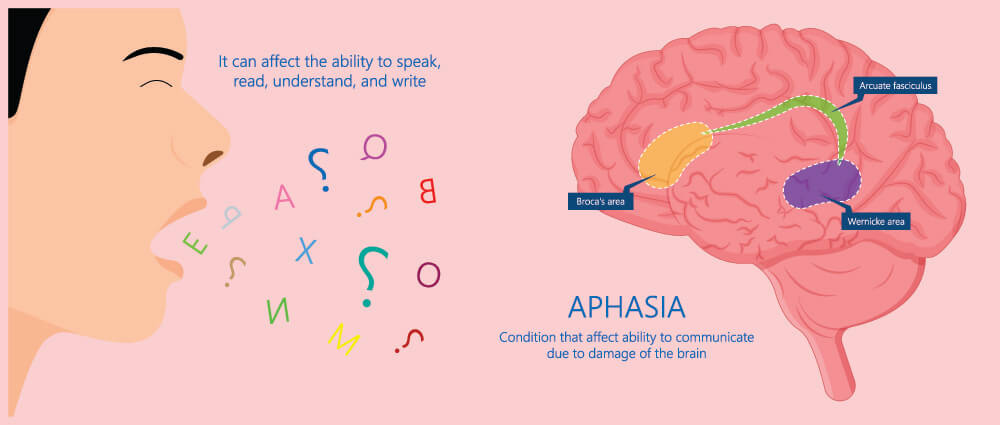 aphasia brain